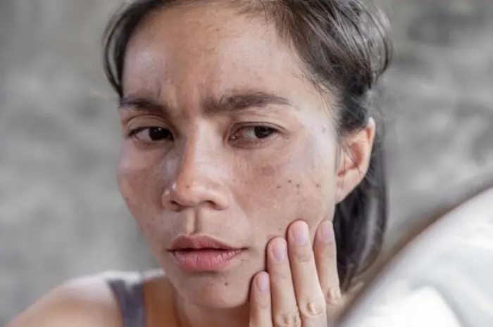 Strategi Mengatasi Masalah Kulit Kering dan Kusam